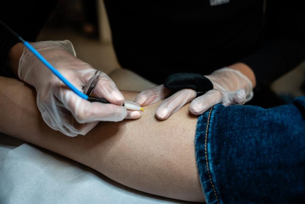 Centre de thermolyse à Paris