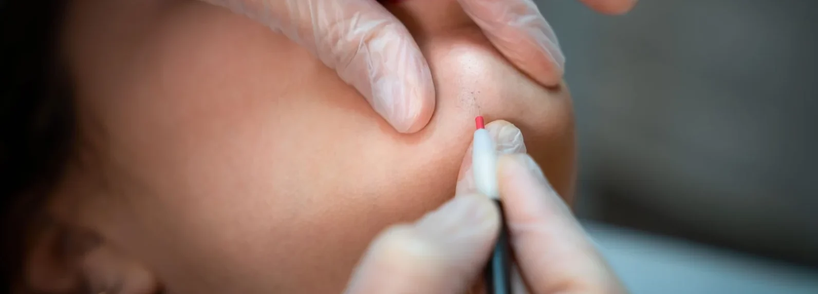 Qu’est-ce que la thermolyse ?​