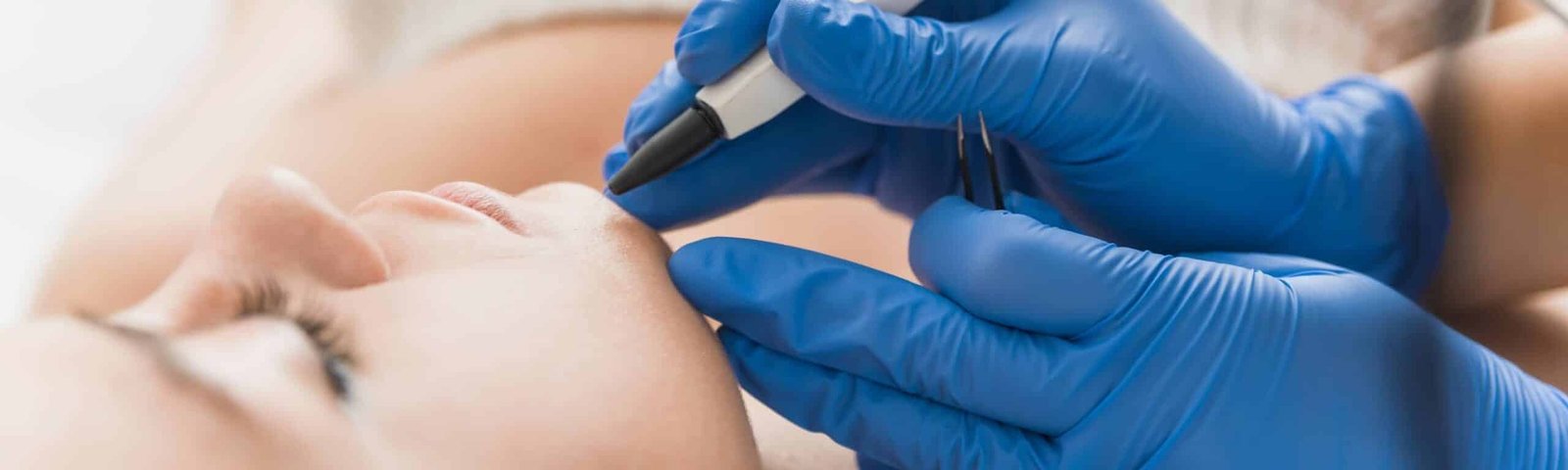 Top 10 des meilleurs centres de thermolyse à Paris